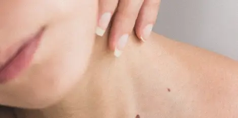 treatment banner